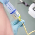 NG Tube Care at Home – Professional & Safe Patient Support