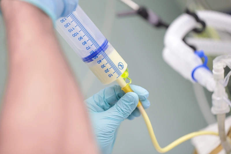 NG Tube Care at Home – Professional & Safe Patient Support